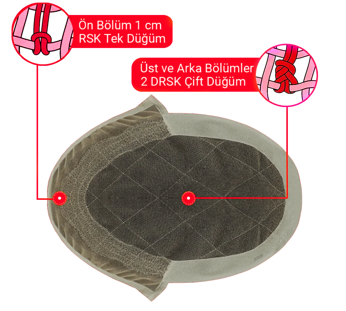 çanakkale protez saç