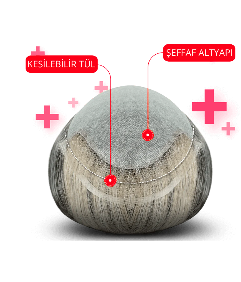 kesilebilir tül sistem